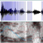 Spectogram